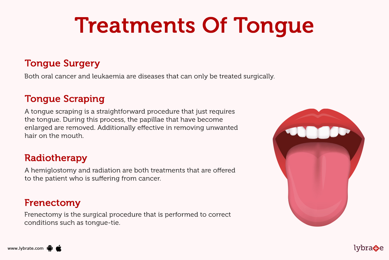 Tongue (Human Anatomy) Image, Function, Definition, Problems, and More