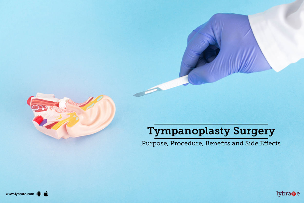 Tympanoplasty Surgery: Purpose, Procedure, And Benefits And Side Effects