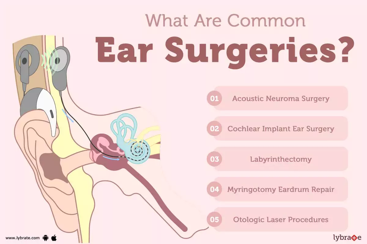 Otoplasty Causes, Treatment, Home Remedies And More!
