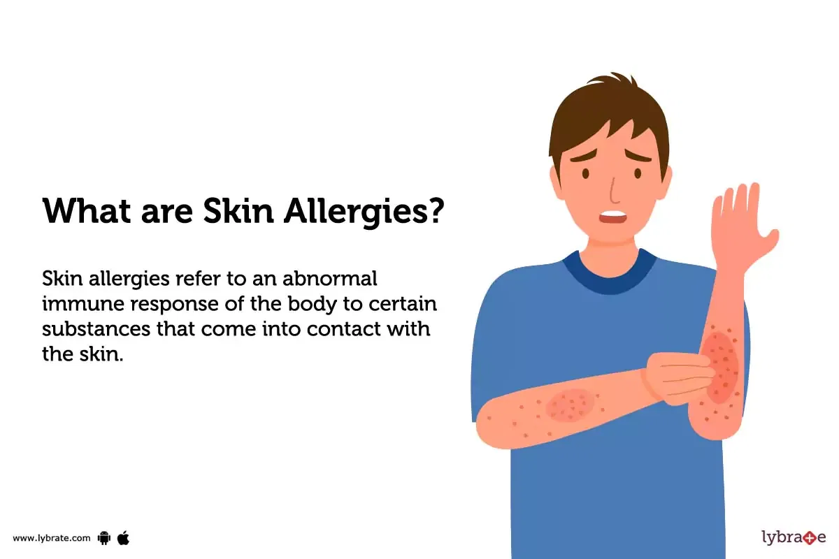 skin-allergies-types-symptoms-causes-and-diagnosis