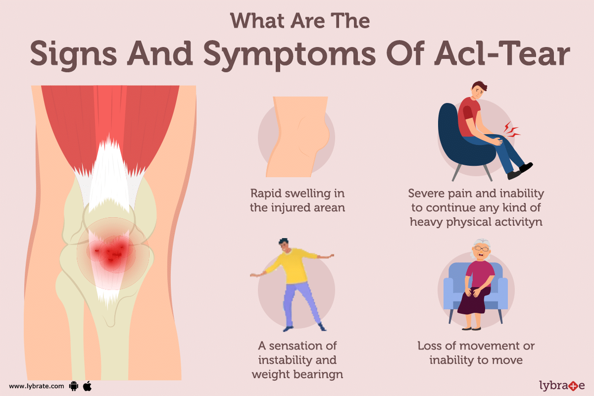 anterior-cruciate-ligament-acl-tear-symptoms-causes-treatment-and