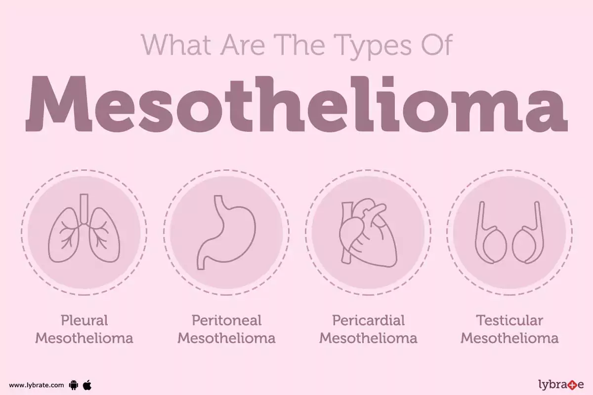 Gorgeous What Is The Meaning Of Mesothelioma Image Art Gorgeous What Is The Meaning Of Mesothelioma Image Art