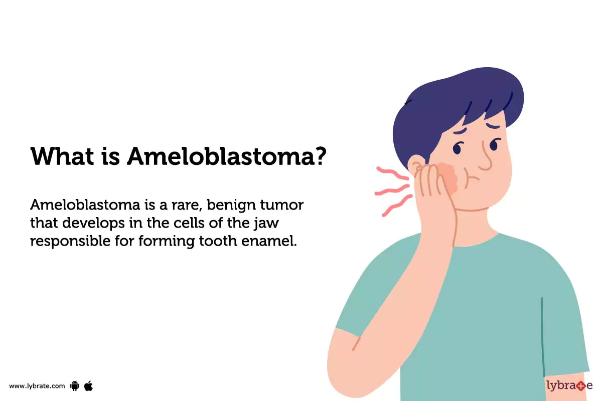 Ameloblastoma Symptoms, Causes, Treatment, and Diagnosis