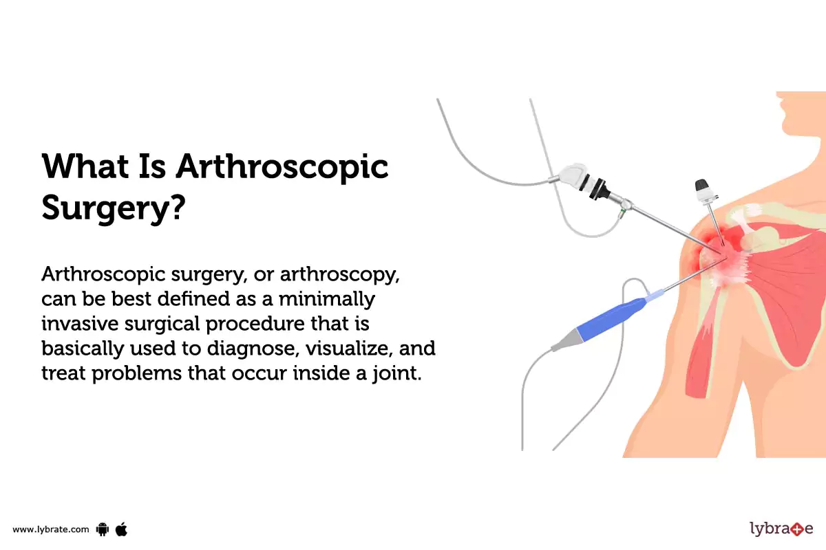 Arthroscopic Surgery Purpose, Procedure, Benefits and Side Effects