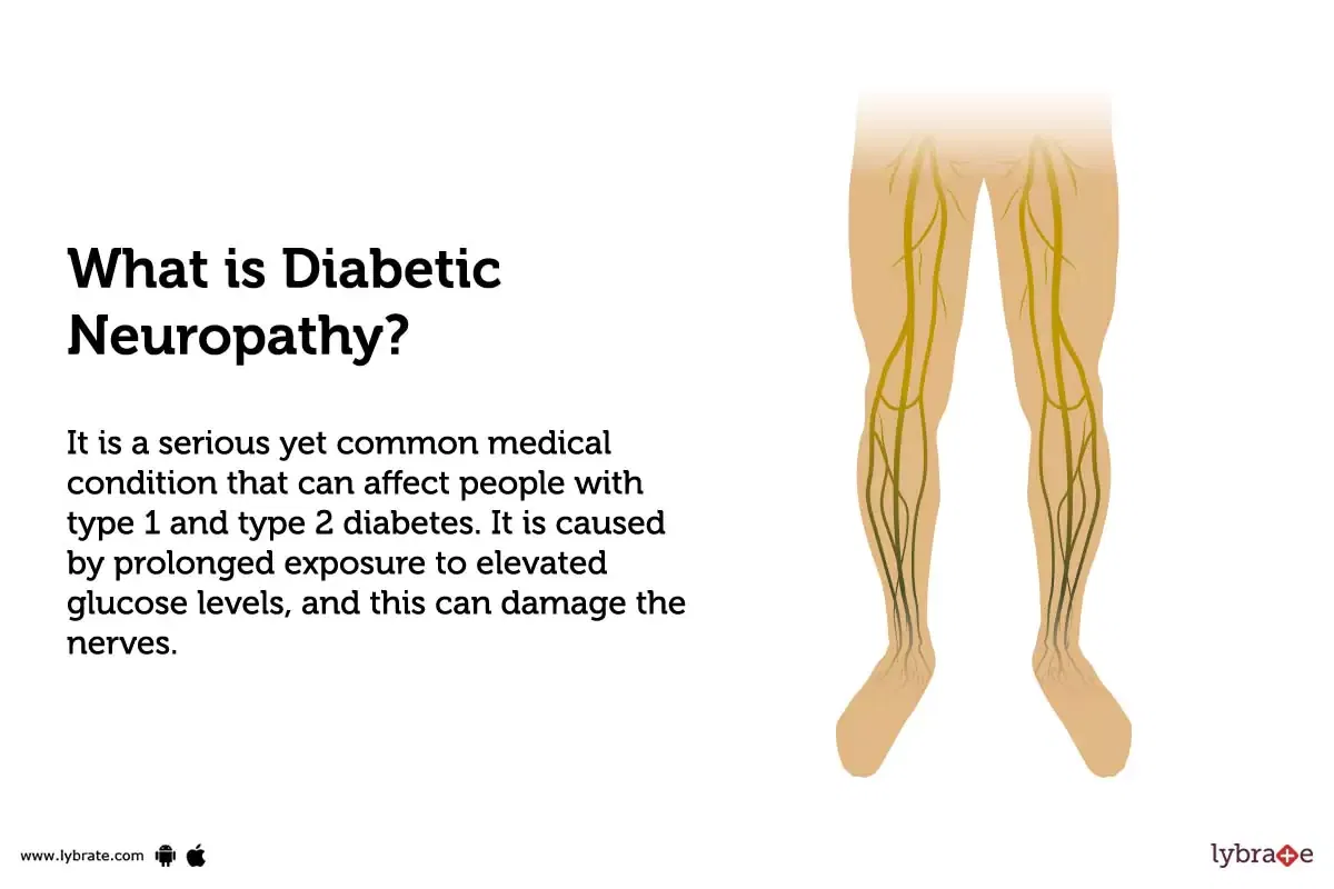 diabetic-neuropathy-treatment-procedure-cost-recovery-side-effects