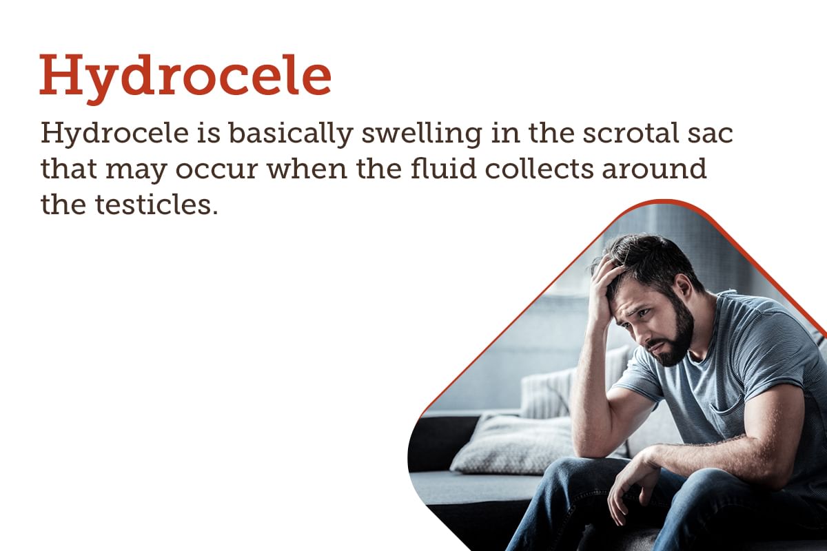 Hydrocele Infection Symptoms Causes Diagnosis Treatments And