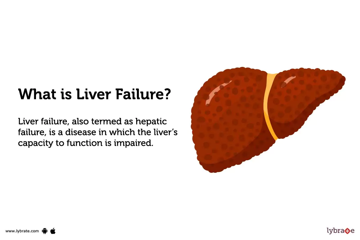 Liver Failure Causes, Symptoms, Treatment and Cost