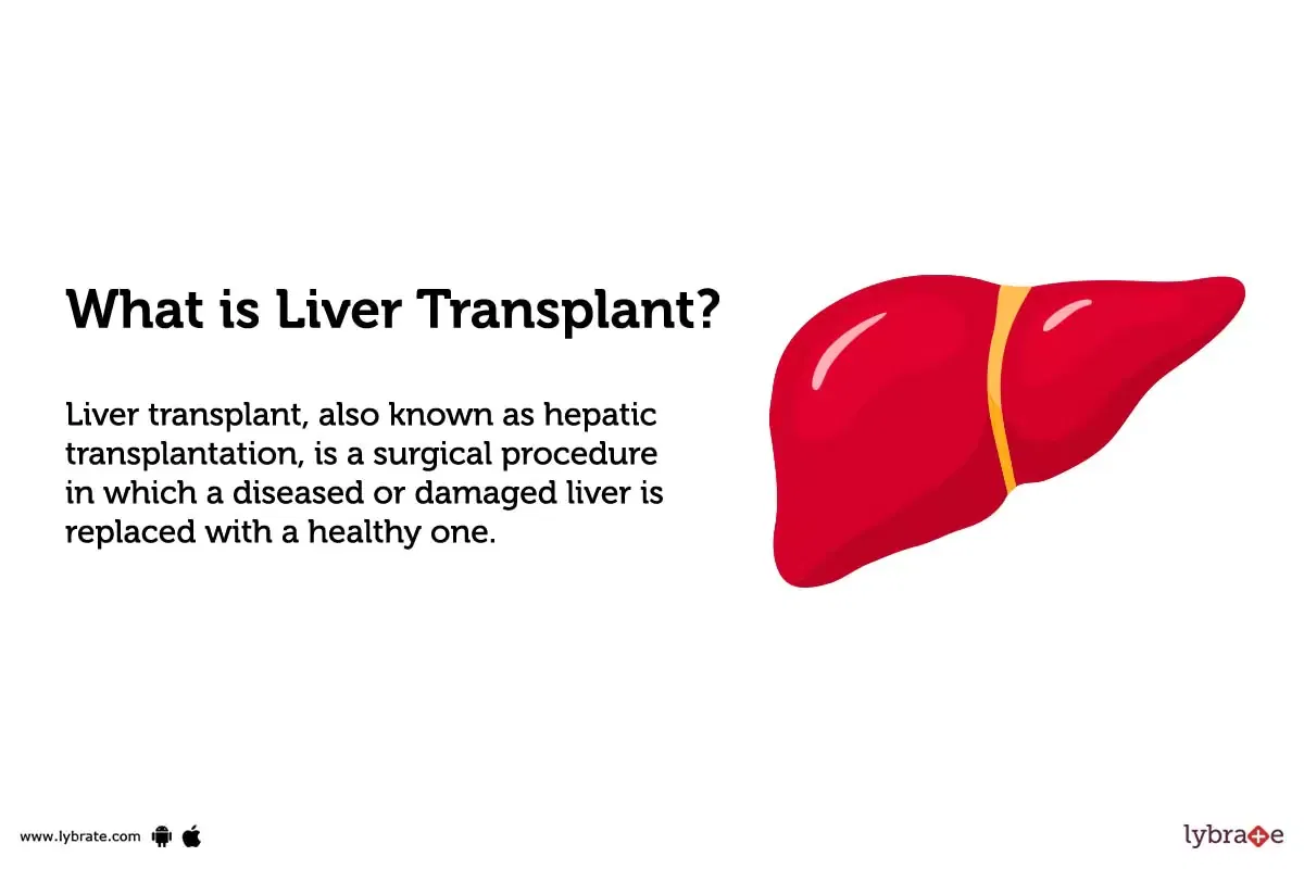 liver-transplantation-part-2-complications