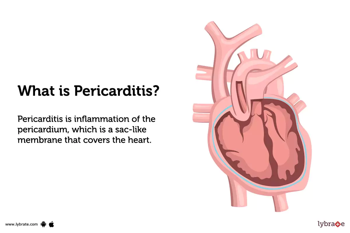 Pericarditis Causes, Symptoms, Treatment and Cost