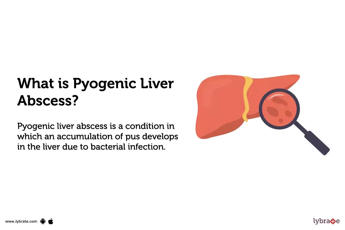 pyogenic-liver-abscess-causes-symptoms-treatment-and-cost