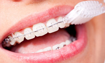 Oral Health Tip