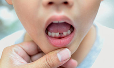 Oral & Dental Health Tips