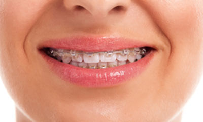 Dental Health Tips!
