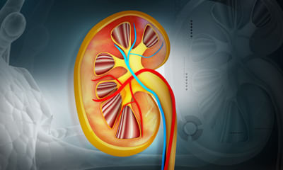 Prevetion Of Kidney Stones!