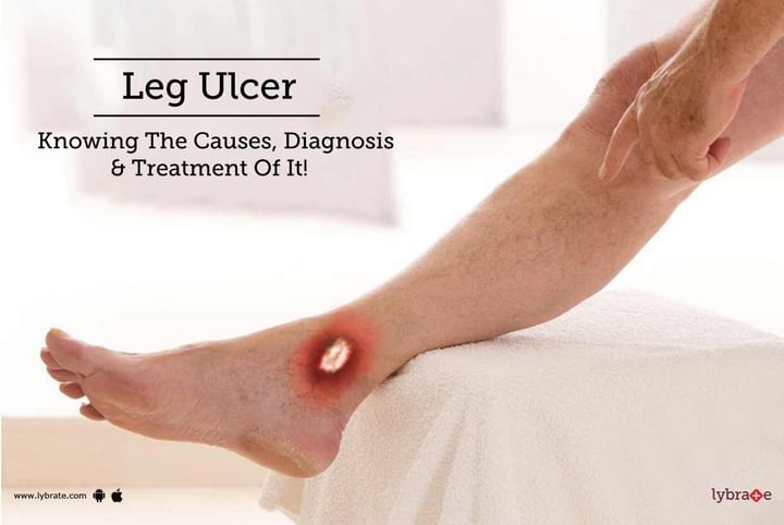 Leg Ulcer Knowing The Causes Diagnosis Treatment Of It By Dr Ramakrishna Pinjala Lybrate