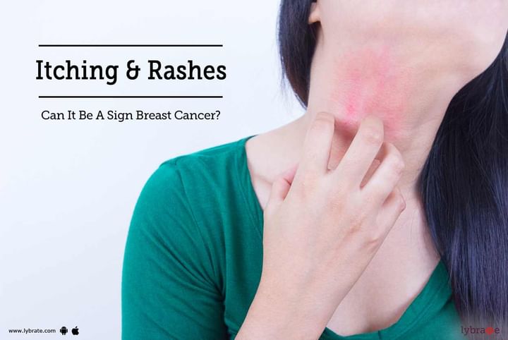 Itching & Rashes - Can It Be A Sign Breast Cancer? - By Dr. Gajanan ...