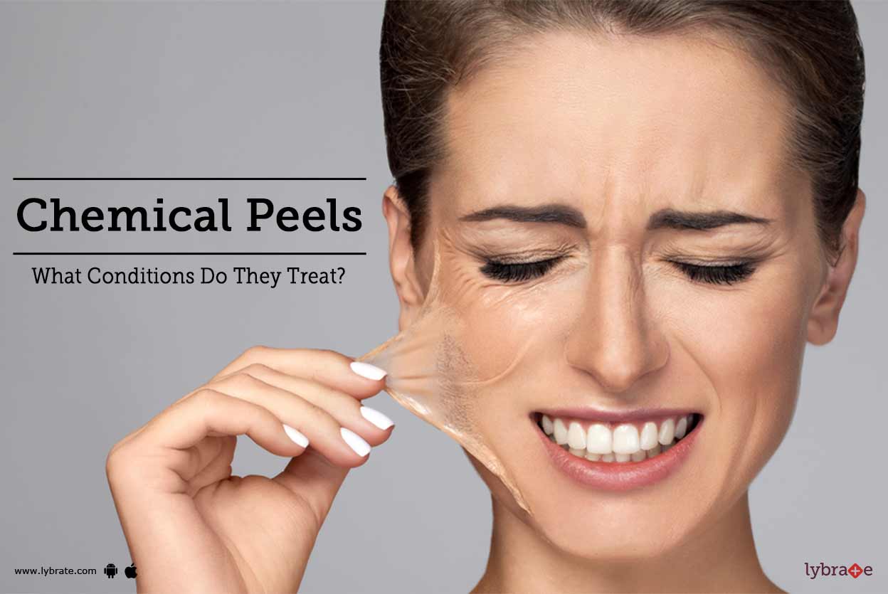 Topic Image