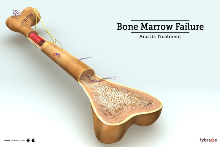 Topic Image
