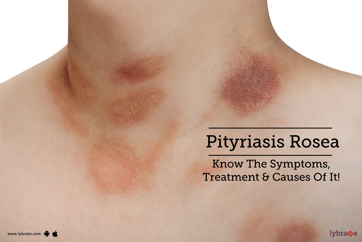 Pityriasis Rosea Know The Symptoms Treatment Causes Of It By Dr 