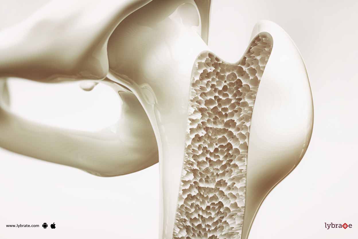 Topic Image