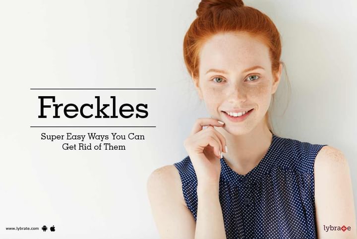 Freckles - Super Easy Ways You Can Get Rid of Them - By Dr. Shruti ...