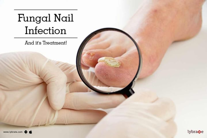 Topic Image