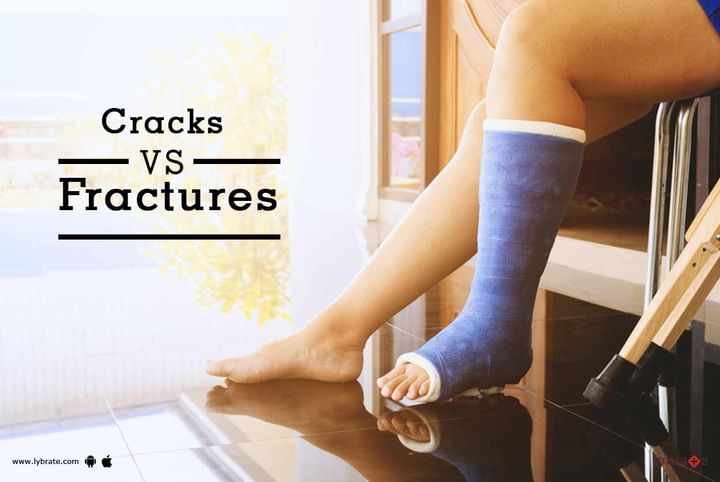 Cracks VS Fractures - By Dr. Debasish Naskar | Lybrate