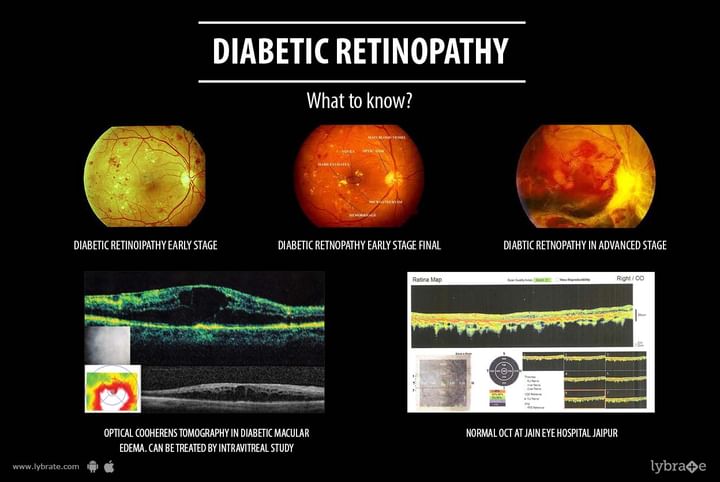 Topic Image