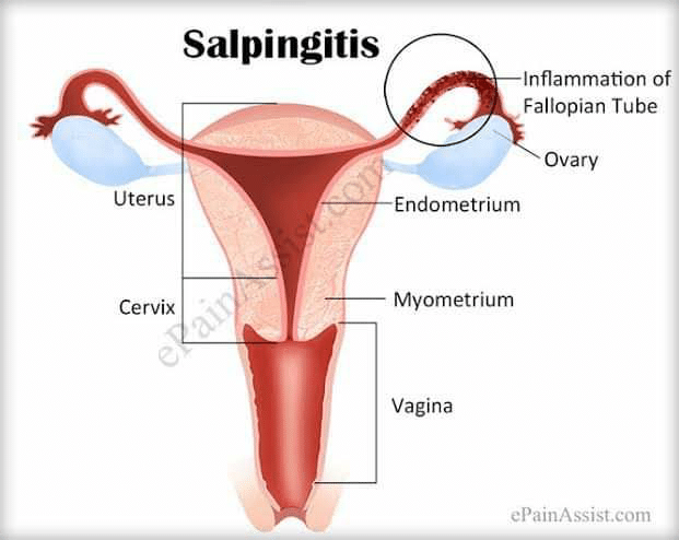 Topic Image