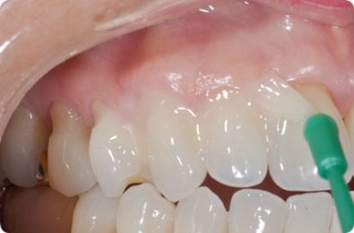 Topic Image