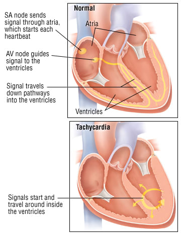 Topic Image