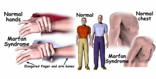 Topic Image