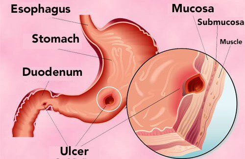 Topic Image