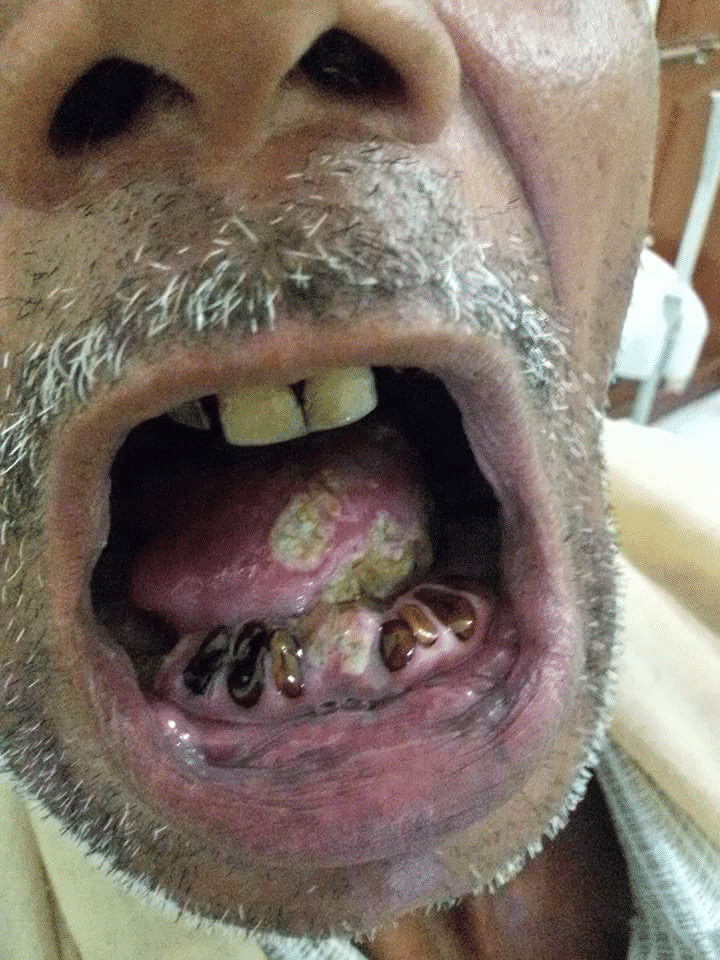 Topic Image