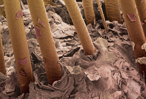 Topic Image