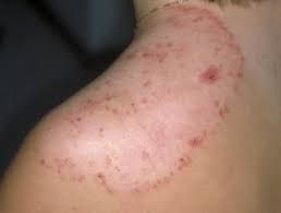 Topic Image