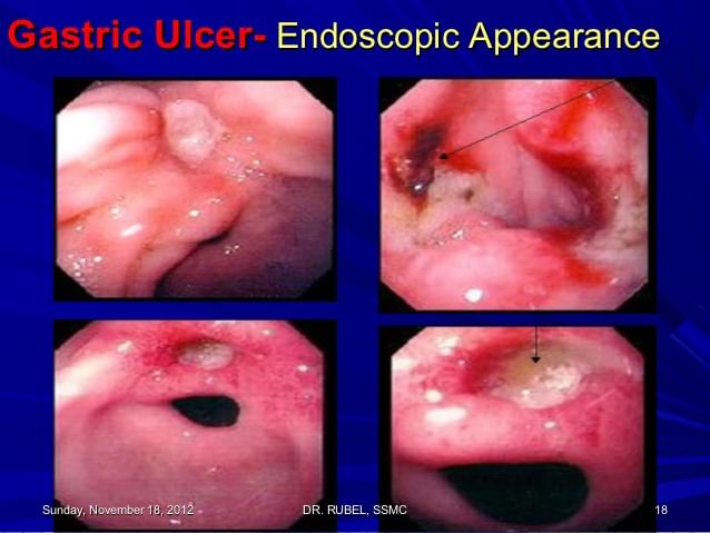 Topic Image