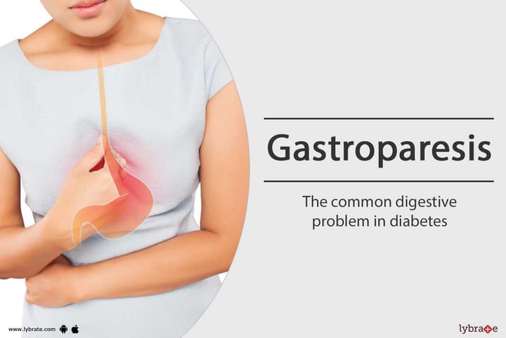 Topic Image