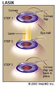 Topic Image