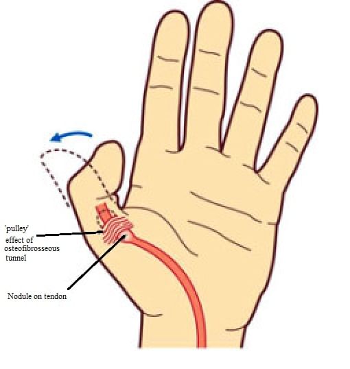 Topic Image