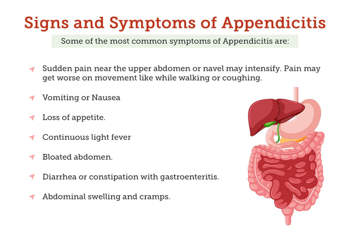 Appendicitis: Know Early Symptoms, Causes, Treatment and Diagnosis