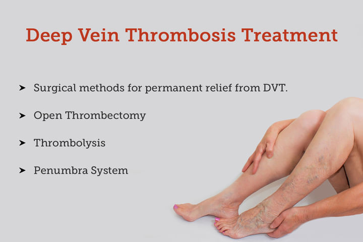 Deep Vein Thrombosis - Dvt: Treatment, Procedure, Cost, Recovery, Side ...