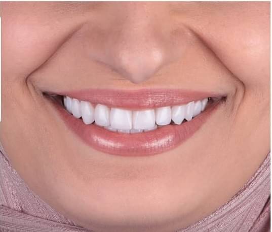 Bright Smile Dental Hospital Wellness Centre In Sultanwind Road Amritsar Book Appointment View Contact Number Feedbacks Address Dr Bikramjeet Singh