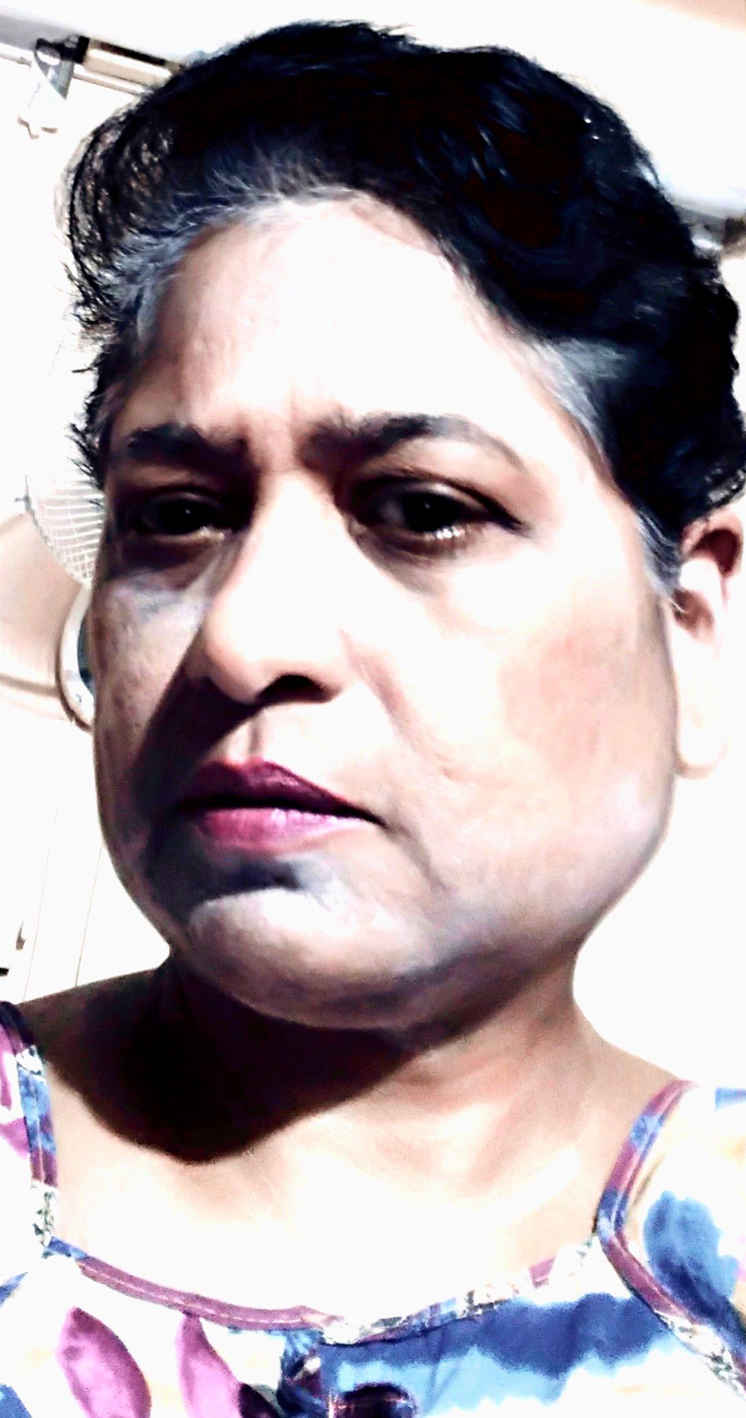 Ent Specialists In Care Hospital Nampally Hyderabad Book Instant Appointment Consult Online View Fees Contact Numbers Feedbacks Ent Specialists In Care Hospital Nampally Hyderabad Book Instant Appointment Consult Online View Fees Contact Numbers Feedbacks