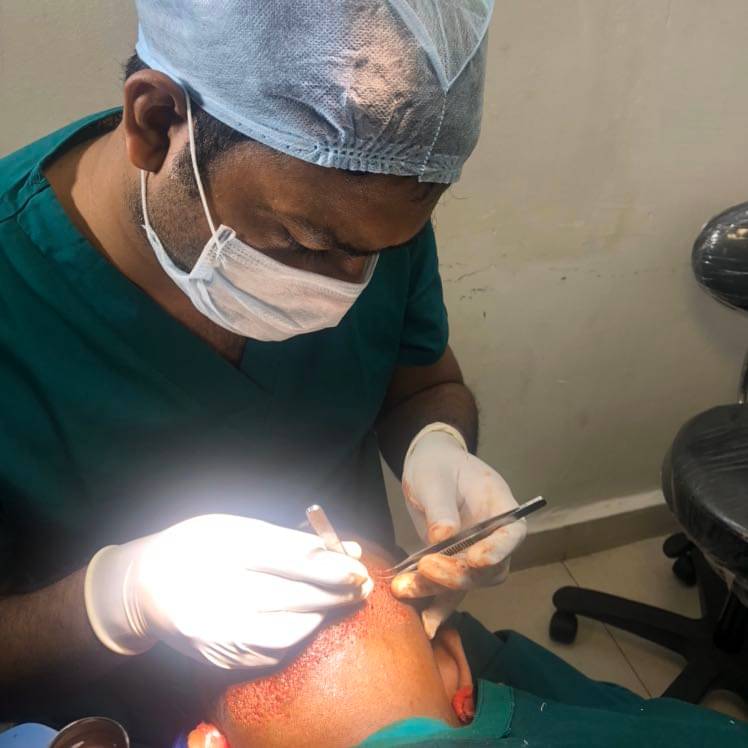 FUE Hair Transplant Doctors in Vijayawada - View Cost, Book Appointment,  Consult Online