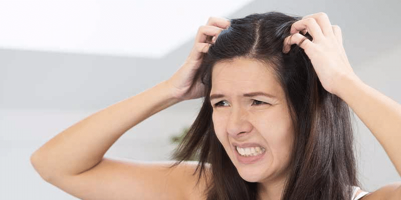 Dandruff - Interesting Facts!