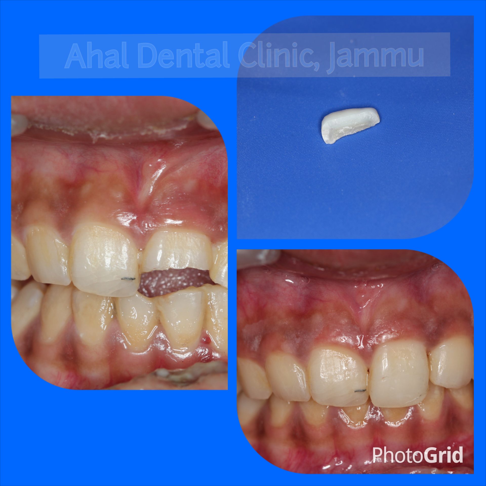 Tip Image