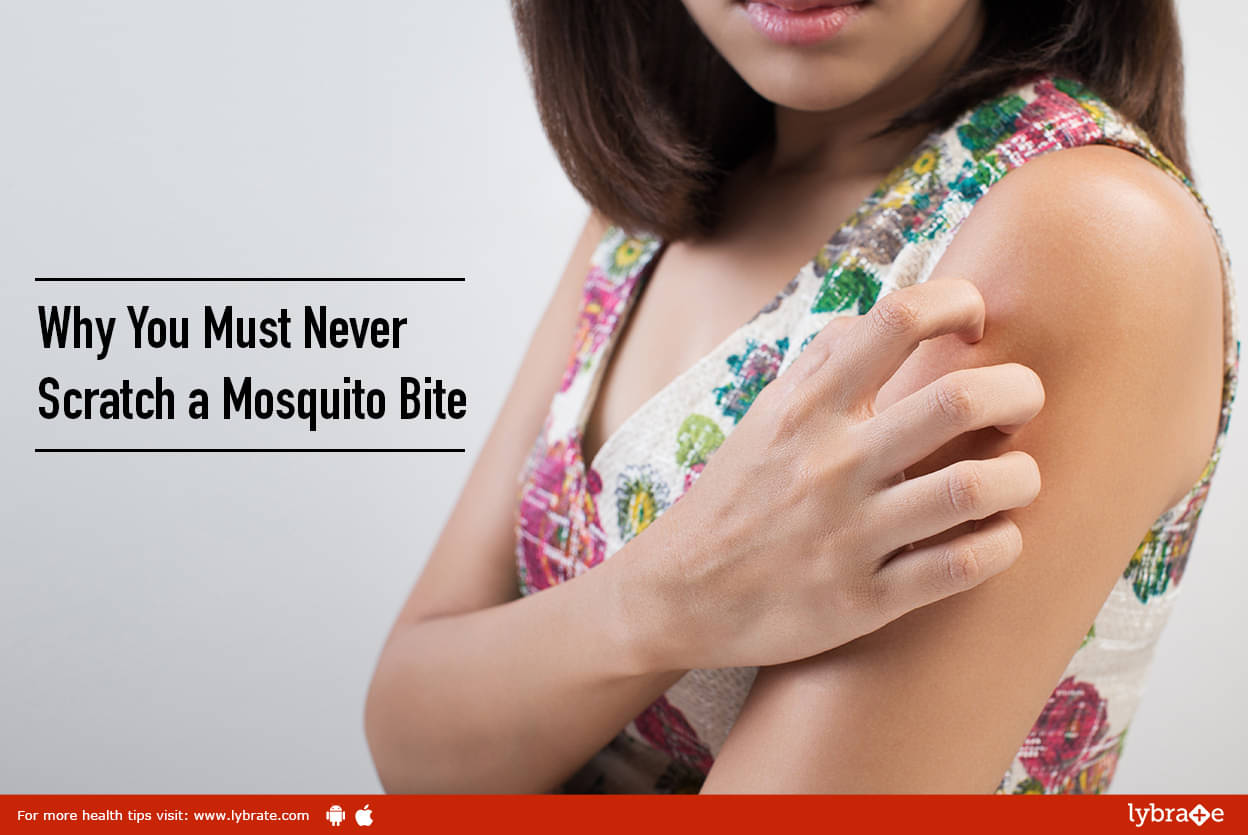 why-you-must-never-scratch-a-mosquito-bite-by-dr-dhruba-bhattacharya