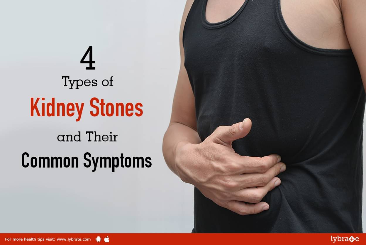 4 Types of Kidney Stones and Their Common Symptoms - By Dr. L.K. Jha ...