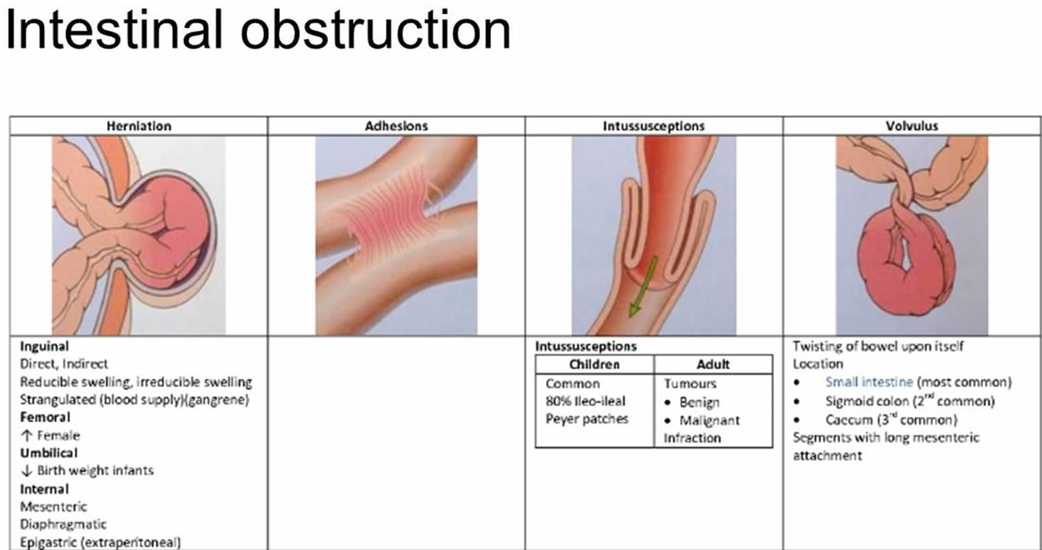 Another Way To Say Intestinal Obstruction